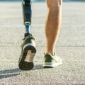 What is a catastrophic leg injury?
