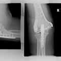 Can you recover from a catastrophic injury?