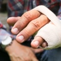 Is a broken arm a catastrophic injury?