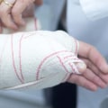 What would be considered a serious injury?