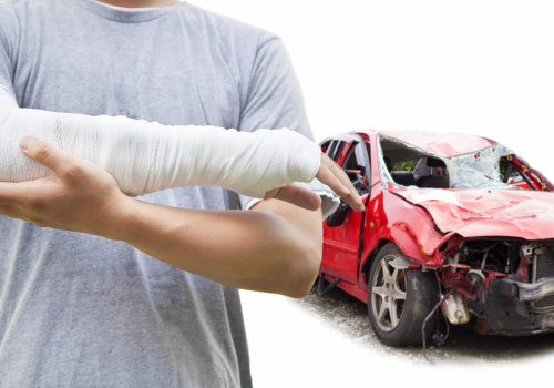 The Importance Of Hiring A Catastrophic Injury Lawyer After An Auto Accident In Laurel, MS