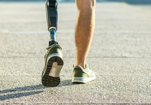 What is a catastrophic leg injury?