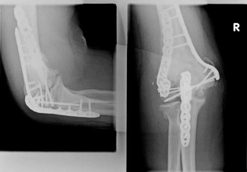Can you recover from a catastrophic injury?